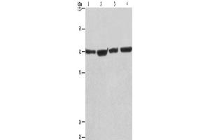 Western Blotting (WB) image for anti-Kruppel-Like Factor 11 (KLF11) antibody (ABIN2428323) (KLF11 抗体)