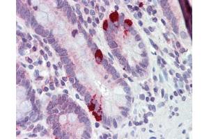 Immunohistochemistry (IHC) image for anti-Solute Carrier Family 39 (Metal Ion Transporter), Member 5 (SLC39A5) antibody (ABIN635718)