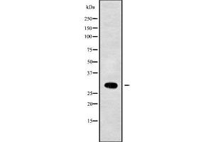 Western blot analysis NKX22 using Jurkat whole cell lysates (Nkx2-2 抗体  (Internal Region))