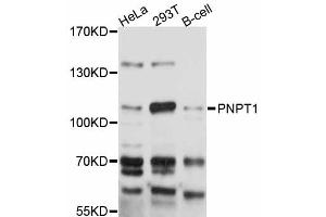 Western blot analysis of extracts of various cell lines, using PNPT1 antibody (ABIN5998548) at 1:3000 dilution. (PNPT1 抗体)