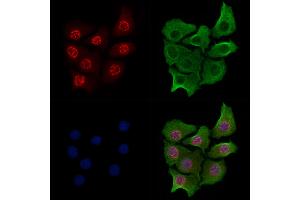 Phospho-RPA32/RPA2 (Ser4/Ser8) Antibody staining Hela cells(heat shock treatment) by IF/ICC.