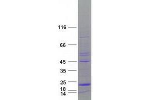 Western Blotting (WB) image for Mitochondrial Fission Process 1 (Mtfp1) (Transcript Variant 1) protein (Myc-DYKDDDDK Tag) (ABIN2726556)