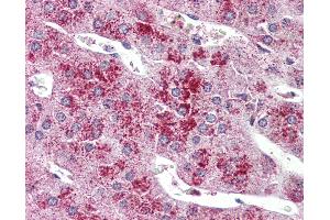 Anti-GLP2R antibody IHC of human adrenal. (GLP2R 抗体  (C-Term))