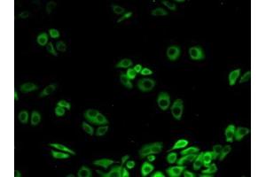 Detection of CACYBP in Human Hela Cells using Polyclonal Antibody to Calcyclin Binding Protein (CACYBP) (CACYBP 抗体  (AA 2-228))