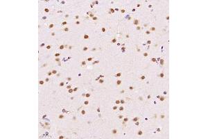 Immunohistochemistry (Paraffin-embedded Sections) (IHC (p)) image for anti-Ubiquitin Specific Peptidase 34 (USP34) antibody (ABIN7076115)