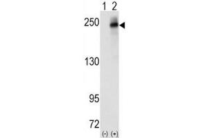 Western blot analysis of ALK antibody and 293 cell lysate (2 ug/lane) either nontransfected (Lane 1) or transiently transfected with the human gene (2). (ALK 抗体  (AA 636-666))