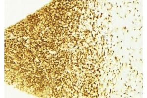 Immunohistochemistry (IHC) image for anti-Cyclin-Dependent Kinase Inhibitor 1B (p27, Kip1) (CDKN1B) (pThr187) antibody (ABIN6256493)