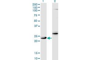 Western Blot analysis of GSTZ1 expression in transfected 293T cell line by GSTZ1 monoclonal antibody (M01), clone 1G12. (GSTZ1 抗体  (AA 109-216))