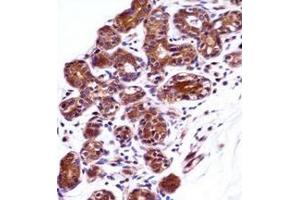 Immunohistochemistry analysis in formalin fixed and paraffin embedded human breast tissue reacted with IMPDH1 / IMPD1 Antibody (N-term) followed by peroxidase conjugation of the secondary antibody and DAB staining.