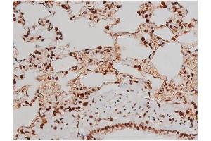 Immunohistochemistry (IHC) image for anti-Mast/stem Cell Growth Factor Receptor (KIT) (pTyr721) antibody (ABIN6256004)