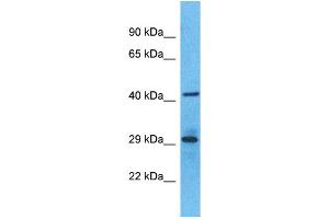 Western Blotting (WB) image for anti-Olfactory Receptor, Family 6, Subfamily S, Member 1 (OR6S1) (C-Term) antibody (ABIN2791769) (OR6S1 抗体  (C-Term))