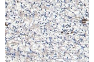 Immunohistochemistry (IHC) image for anti-S100 Calcium Binding Protein A8 (S100A8) (AA 1-93) antibody (ABIN7428836)