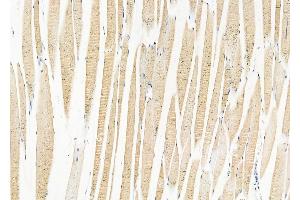 anti-Unc-51 Like Kinase 2 (ULK2) (Internal Region) antibody