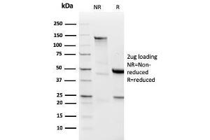 SDS-PAGE Analysis Purified Lambda Light Chain Recombinant Rabbit Monoclonal (LLC/3778R). (Recombinant IgL 抗体)