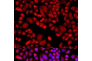 Immunofluorescence analysis of A549 cells using ARPC3 Polyclonal Antibody (ARPC3 抗体)