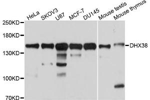 Western blot analysis of extracts of various cell lines, using DHX38 antibody. (DHX38 抗体)