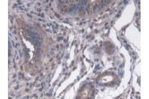 Detection of CYP-40 in Mouse Uterus Tissue using Polyclonal Antibody to Cyclophilin 40 (CYP-40) (PPID 抗体  (AA 9-189))