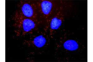 Proximity Ligation Analysis of protein-protein interactions between PDGFRB and SLC9A3R1. (PDGFRB 抗体  (AA 1-1106))