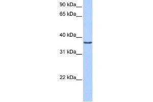 WB Suggested Anti-VGLL2 Antibody Titration:  0. (VGLL2 抗体  (Middle Region))
