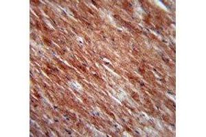 IL-2 antibody immunohistochemistry analysis in formalin fixed and paraffin embedded mouse heart tissue. (IL-2 抗体  (AA 50-77))
