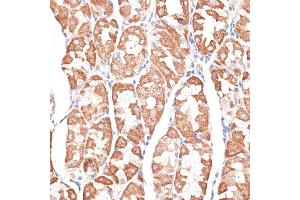 Immunohistochemistry of paraffin-embedded human stomach using KIF4A antibody (ABIN6128156, ABIN6142873, ABIN6142874 and ABIN6214349) at dilution of 1:100 (40x lens). (KIF4A 抗体  (AA 870-1080))