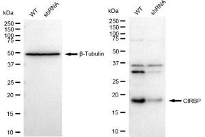 Western blotting analysis using CIRBP antibody (ABIN7798120). (Recombinant CIRBP 抗体)