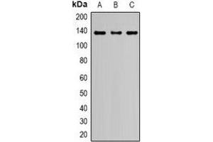 Western blot analysis of Nephrin expression in HeLa (A), HEK293T (B), PC12 (C) whole cell lysates. (Nephrin 抗体  (C-Term))
