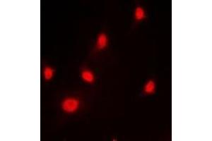 Immunofluorescent analysis of hnRNP L staining in HeLa cells. (HNRNPL 抗体)
