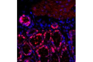 Immunofluorescence (Paraffin-embedded Sections) (IF (p)) image for anti-Prothymosin, alpha (PTMA) antibody (ABIN7075306)