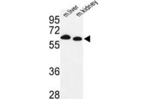 Western Blotting (WB) image for anti-Proline Dehydrogenase (Oxidase) 1 (PRODH) antibody (ABIN3003837) (PRODH 抗体)