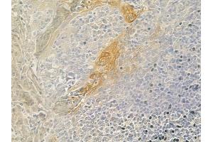 ABIN6260768 and ABIN6279276 at 1/100 staining human normal tonsil tissue by IHC-P.