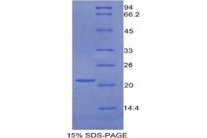 SDS-PAGE of Protein Standard from the Kit  (Highly purified E. (GAS6 ELISA 试剂盒)