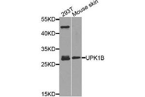 Western blot analysis of extracts of various cell lines, using UPK1B antibody. (Uroplakin 1B 抗体  (AA 110-230))