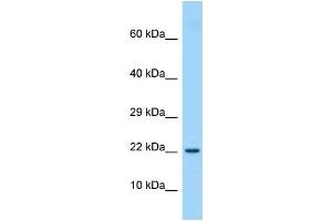 Host: Rabbit Target Name: Etv3l Sample Type: Rat Thymus lysates Antibody Dilution: 1. (ETV3L 抗体  (Middle Region))