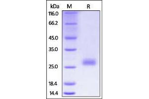 Mouse CTLA-4, His Tag on SDS-PAGE under reducing (R) condition. (CTLA4 Protein (AA 36-162) (His tag))