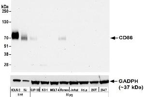 Western Blotting (WB) image for anti-CD86 (CD86) (AA 31-245) antibody (ABIN7453375)