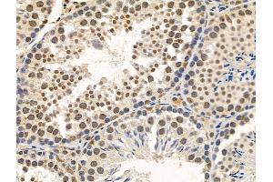 Phospho-TDP43 (Ser409/Ser410) Antibody at 1/100 staining Mouse testis tissue by IHC-P.