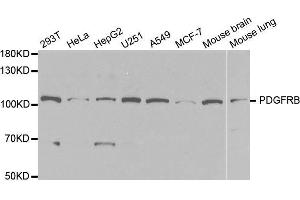 Western blot analysis of extracts of various cell lines, using PDGFRB antibody. (PDGFRB 抗体  (AA 887-1106))
