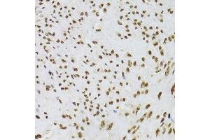 Immunohistochemistry of paraffin-embedded human leiomyoma of uterus using XRCC6 Antibody.