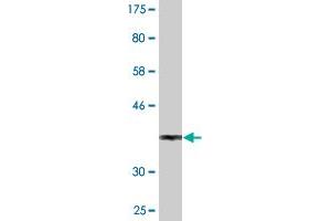 Western Blot detection against Immunogen (36. (SEPHS1 抗体  (AA 1-96))