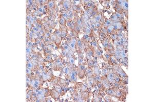 Immunohistochemistry of paraffin-embedded human liver using Alpha Fodrin Rabbit mAb (ABIN7270518) at dilution of 1:100 (40x lens). (SPTAN1 抗体)