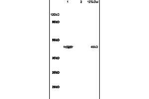 L1 rat brain lysates L2 rat heart lysates probed with Anti ADRB2 Polyclonal Antibody, Unconjugated (ABIN730153) at 1:200 in 4 °C. (beta 2 Adrenergic Receptor 抗体  (AA 201-300))