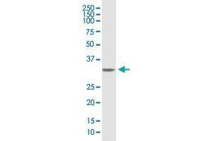 Western Blotting (WB) image for anti-Syndecan Binding Protein (Syntenin) (SDCBP) (AA 1-298) antibody (ABIN520095)