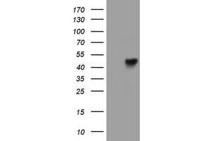 Western Blotting (WB) image for anti-Leucine Rich Repeat Containing 25 (LRRC25) antibody (ABIN1499200)