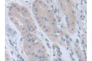 Immunohistochemistry (IHC) image for anti-Retinoic Acid Receptor, alpha (RARA) (AA 68-173) antibody (ABIN7432958)