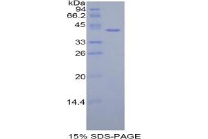 SDS-PAGE analysis of Human HIST1H2AH Protein. (HIST1H2AH 蛋白)