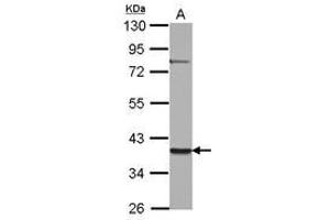 Image no. 1 for anti-Zinc Finger Protein 302 (ZNF302) (AA 1-178) antibody (ABIN1501835) (ZNF302 抗体  (AA 1-178))