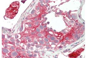 Rabbit Anti-Lrp2bp antibody  Formalin Fixed Paraffin Embedded Tissue: Human Testis Primary antibody Concentration: 1:100 Secondary Antibody: Donkey anti-Rabbit-Cy3 Secondary Antibody Concentration: 1:200 Magnification: 20x Exposure Time: 0. (LRP2BP 抗体  (Middle Region))