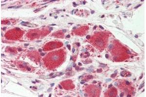 Immunohistochemistry (IHC) image for anti-Potassium Inwardly-Rectifying Channel, Subfamily J, Member 16 (KCNJ16) (AA 369-418) antibody (ABIN2879364)