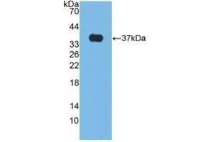 Detection of Recombinant ALP, Bovine using Polyclonal Antibody to Alkaline Phosphatase (ALP) (Alkaline Phosphatase 抗体)
